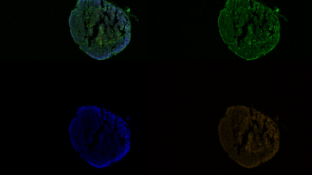 A frog thymus gland with florescent markers for cell death (green), cell nuclei (blue), and epithelial tissue (red)