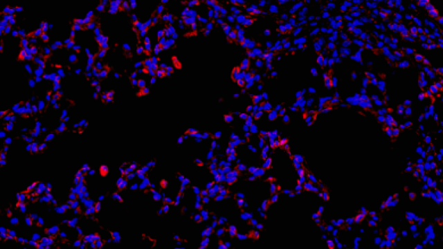 IHC-IF stain of Alveolar Cells