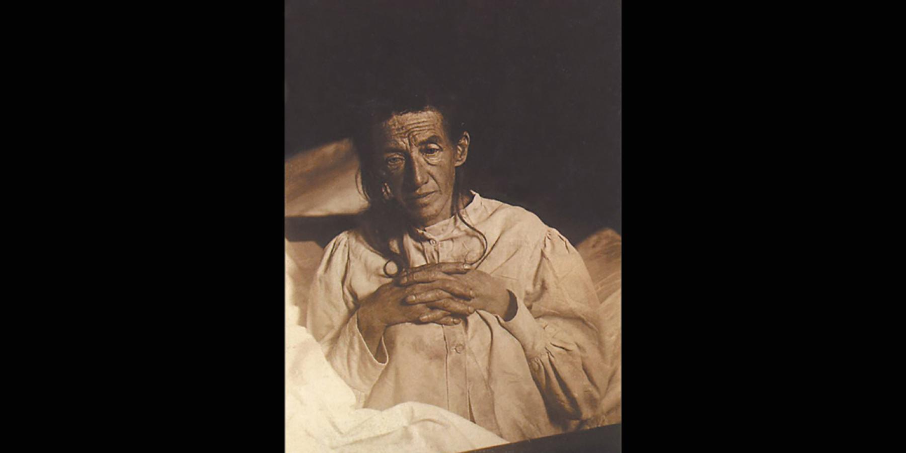 Portrait of Auguste Deter, the first patient diagnosed with Alzheimer&#039;s Disease.