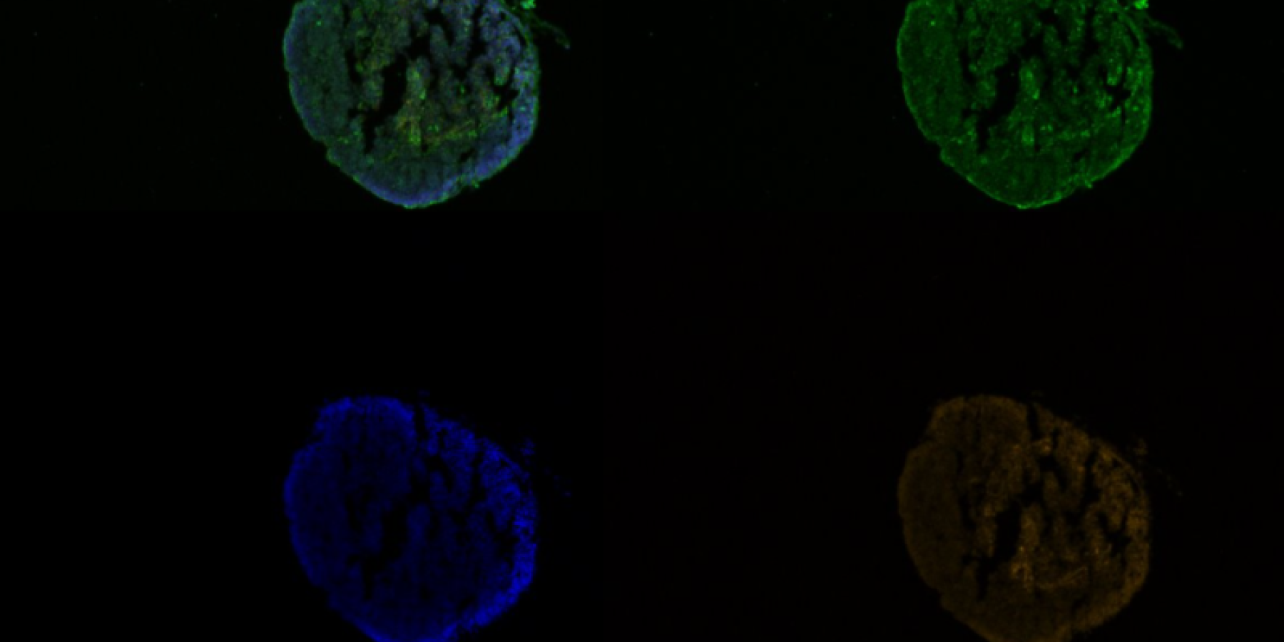 A frog thymus gland with florescent markers for cell death (green), cell nuclei (blue), and epithelial tissue (red)