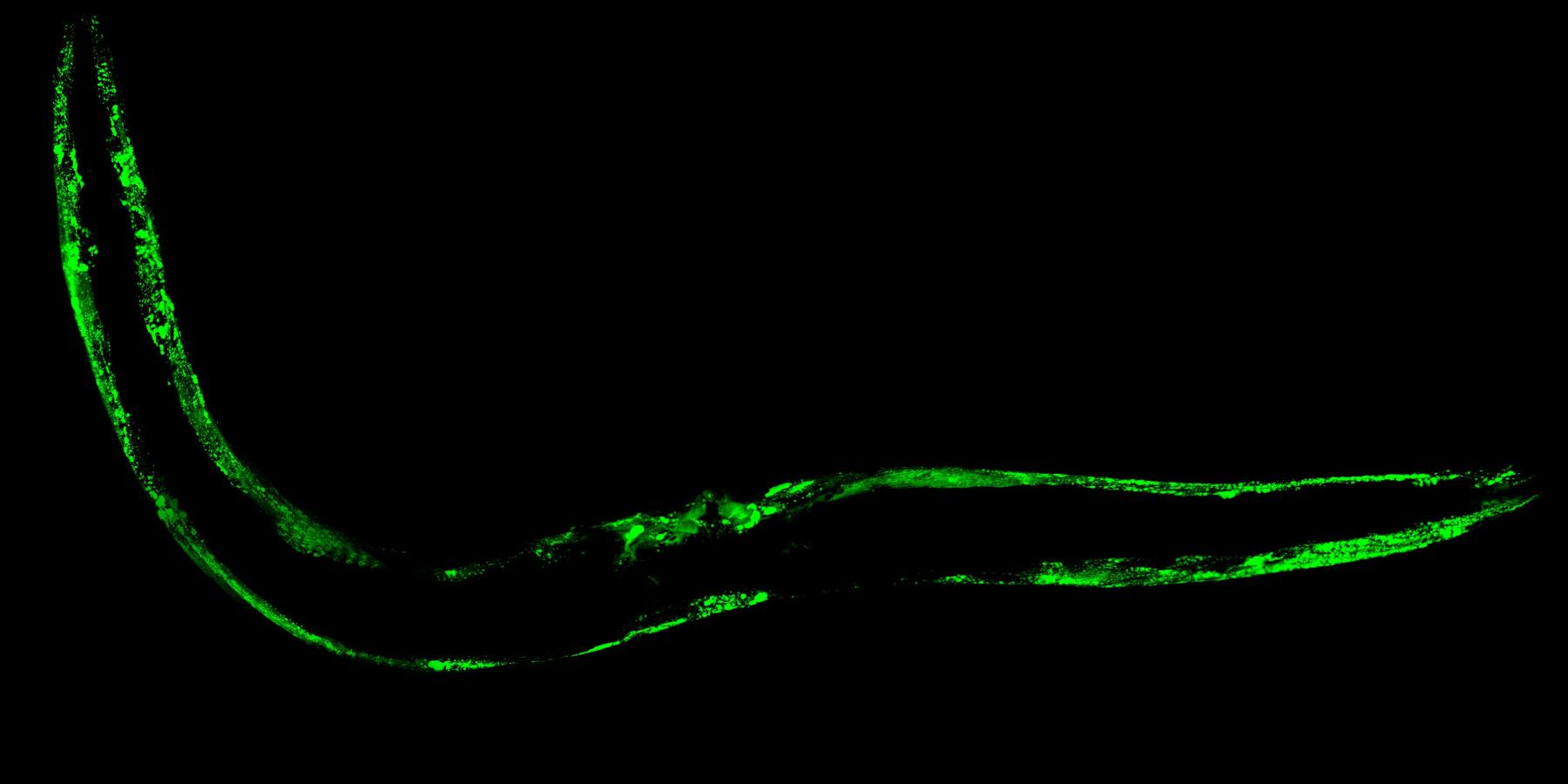 Confocal microscopy image of a Caenorhabditis elegans worm expressing green fluorescent protein-tagged α-synuclein in body wall muscle cells.
