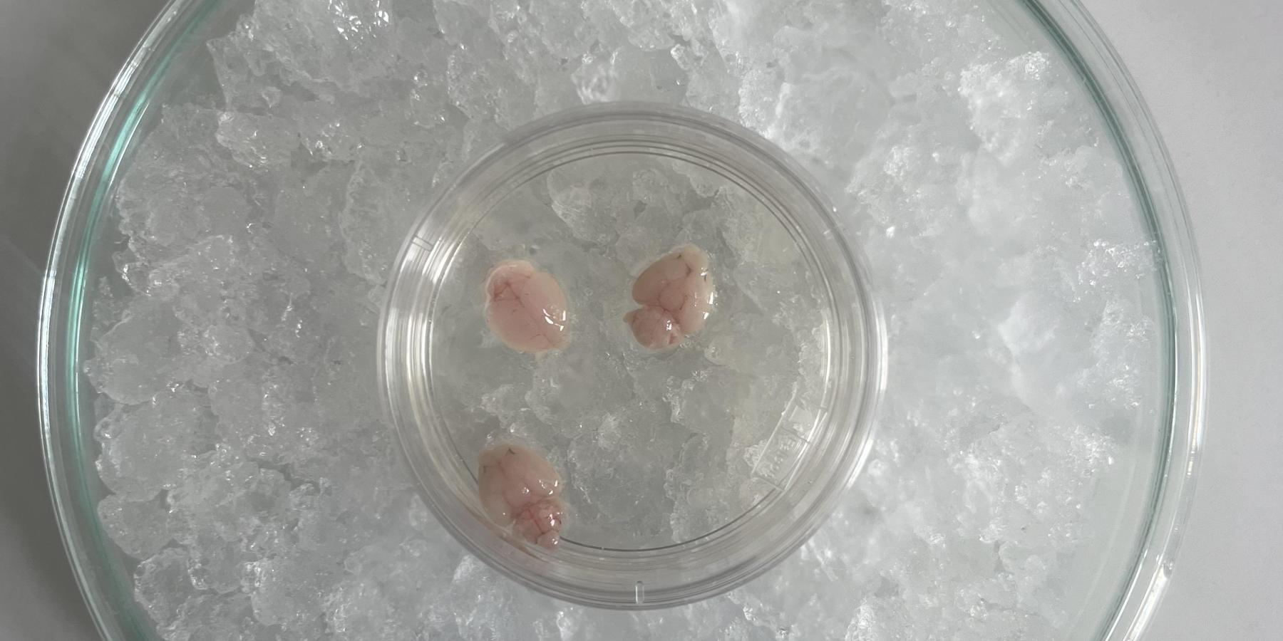 Mice brain on ice.