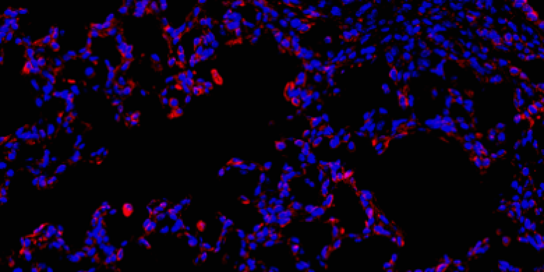 IHC-IF stain of Alveolar Cells