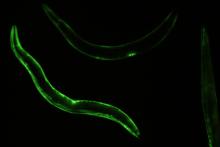 Fluorescent image of C. elegans. 
