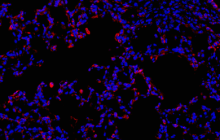 IHC-IF stain of Alveolar Cells