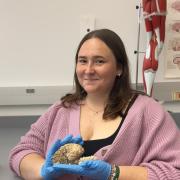 Sara St. Clair holding a preserved brain specimen in a neuroscience lab.